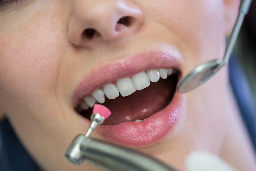 dentista clinica mataro